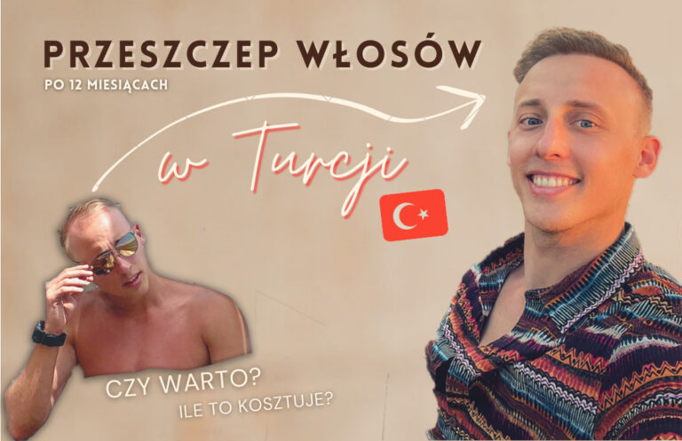 Read more about the article Przeszczep włosów w Turcji – ile kosztuje i czy warto!?